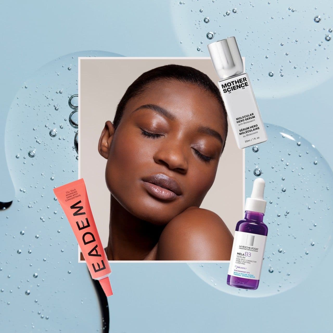 Adult Acne Is Giving Me Post-Inflammatory Hyperpigmentation—These 10 Brightening Products Are Getting Rid of My Dark Spots